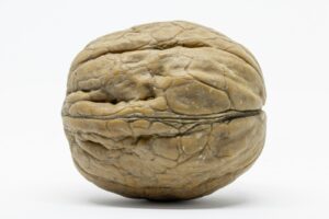 Μπόμπορα Δέσποινα Κετογονική διατροφή και επιληψία