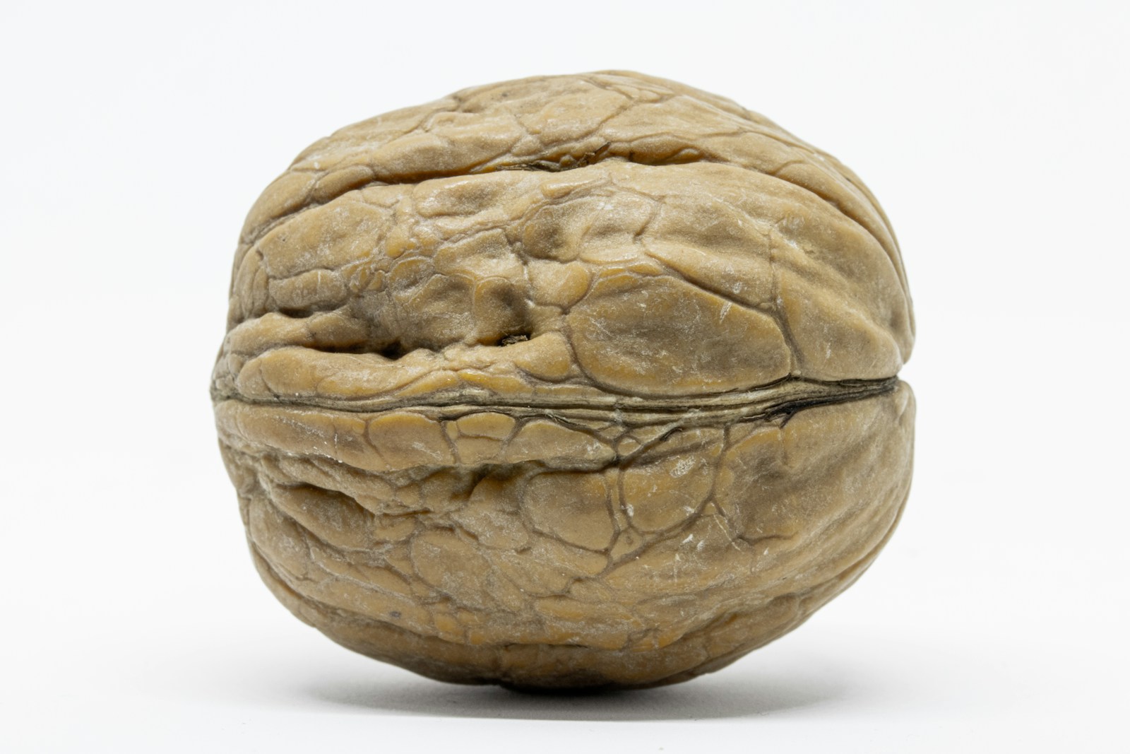 Μπόμπορα Δέσποινα Κετογονική διατροφή και επιληψία